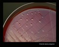 listeria monocytogenes on blood agar
